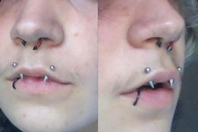 Canine Bites as horizontal lip piercing